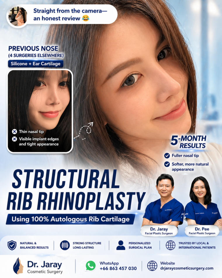 Structural Ribbing Structural Rib Rhinoplasty in Thailand: Refined Results That Look ...